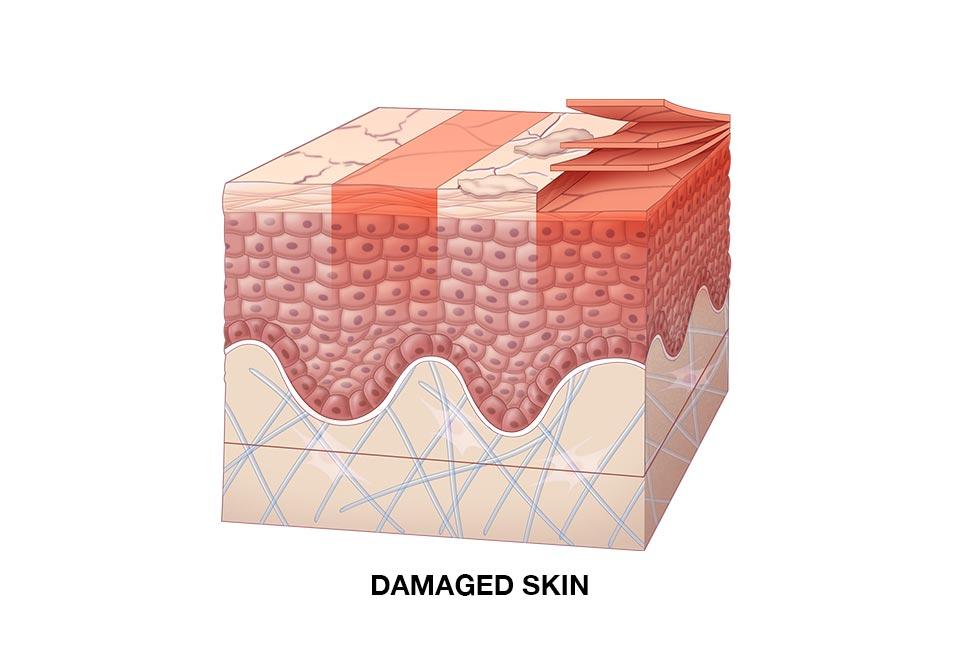 How to repair a damaged skin barrier function | Kiehl's IE